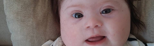 Αυτή είναι η κόρη μου, Λουίζα. Είναι 4 μηνών, έχει δύο χέρια, δύο πόδια, δύο τρυφερά μαγουλάκια, και ένα έξτρα χρωμόσωμα.